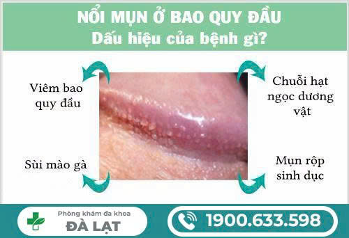 Hình ảnh minh họa